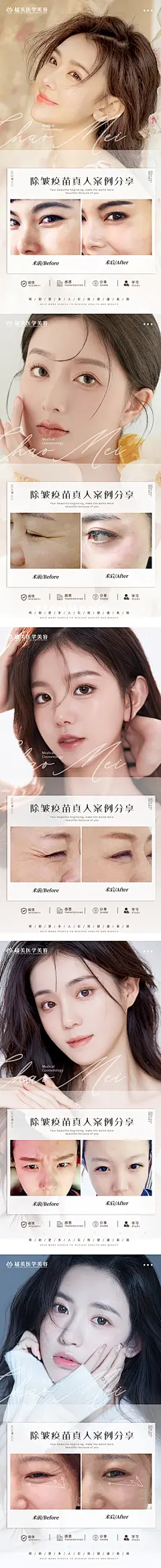 【仙图网】海报 医美 整形 案例 对比 除皱 抗衰   模特 美女  |984292 