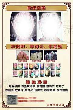 灰指甲座牌名片  - 源文件下载【酷图网】灰指甲,灰指甲介绍,灰指甲说明,灰指甲展板,灰指甲海报,灰指甲文字,关于灰指甲,修脚店,修脚店展板,修脚店海报
