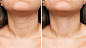 RoC Neck Cream May Improve Wrinkles in As Little as 4 Weeks | Us Weekly