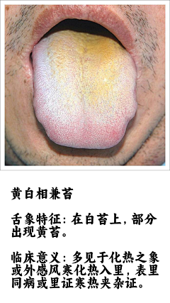 阿宅学医记采集到舌诊图