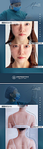 【仙图网】海报 医美 美容 整形 案例 宣传 人物 |1000636 