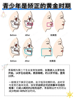 (Youaremysunshine)采集到3D