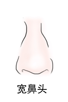 鼻子 鼻小柱 鼻子类型 鼻子分类 朝天鼻 波浪鼻 低鼻 歪鼻 大鼻孔鼻