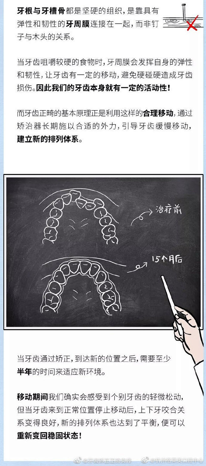 #牙齿矫正小科普# 
牙齿矫正会导致牙齿...