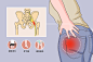 坐骨神经损伤