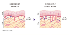 charyslriu采集到详情页-7水分/细胞图