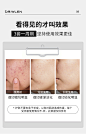 DR.WLEN 寡肽原液修护祛痘套装祛痘淡化痘印痘疤痘坑芦荟胶去痘膏男女青春痘闭口淡化粉刺精华面霜【图片 价格 品牌 评论】-京东