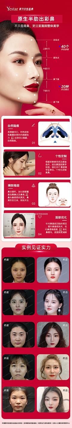 Jesus-LoveYou采集到Y-医美案例