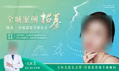 海报 广告展板   医美     模特  案例  招募   创意