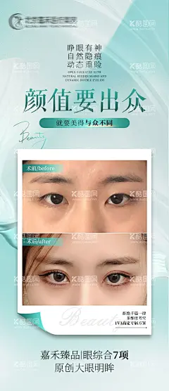 双眼皮案例海报  - 源文件下载【酷图网】海报,医美,双眼皮,眼综合,案例,对比,
