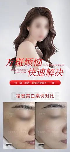 美业祛斑祛痘案例海报设计师美业祛斑祛痘案例海报-志设网-zs9.com