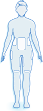 CoolSculpting® Before & After Pictures | CoolSculpting® : See before and after photos of the CoolSculpting® procedure results that show how this alternative to surgical fat reduction may get rid of stubborn fat.