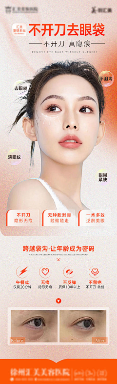 是xing哥啊采集到医美
