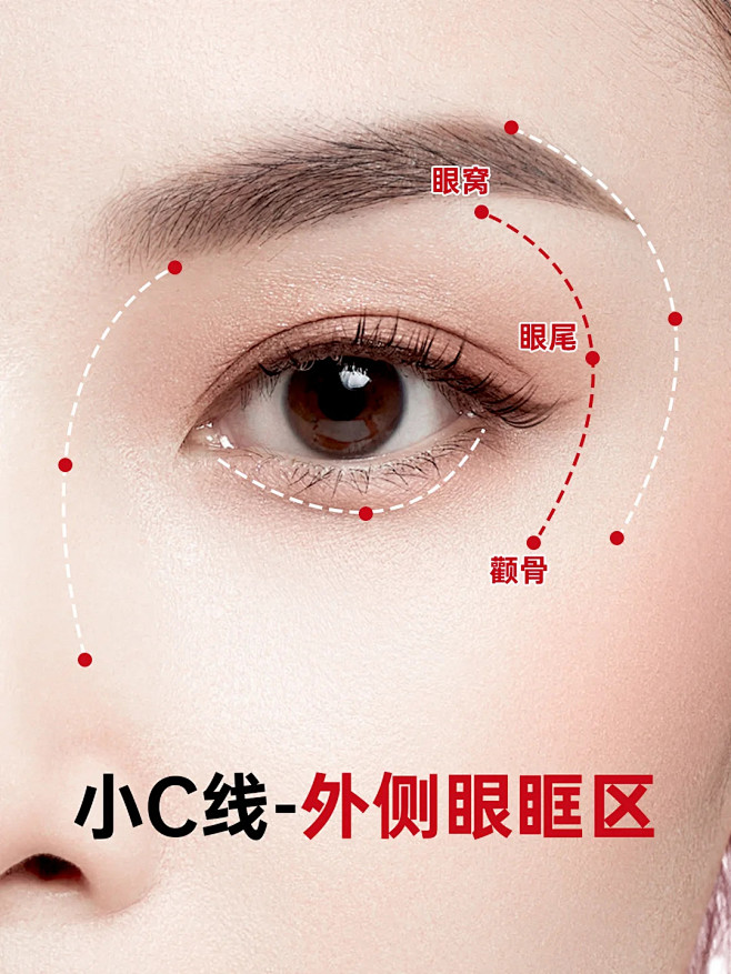 眼周年轻化-4C线