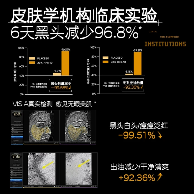 进口清洁泥膜去黑头闭口粉刺收缩毛孔深层补...