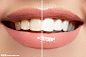 牙线与牙齿