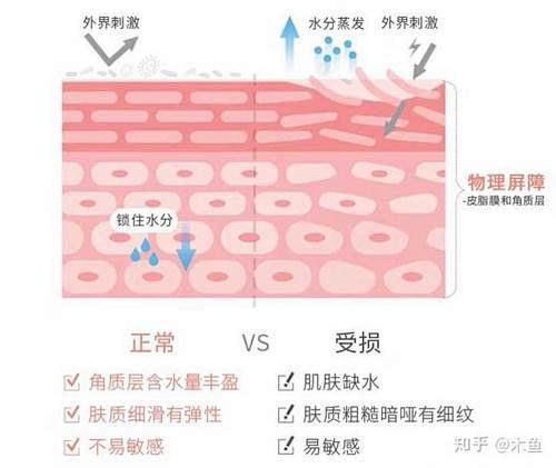 皮肤屏障受损_百度图片搜索