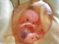 10-week-old baby in utero. Breathtaking.