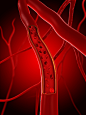 Arteria