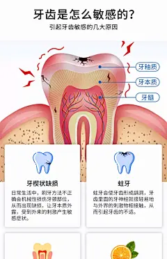 医用脱敏专用牙膏糊剂牙齿牙周炎口腔抗敏牙龈出血护理防蛀含氟NN-tmall.com天猫