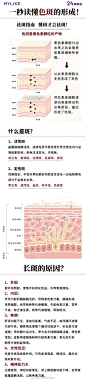 斑点类型多种多样
想要解决色斑问题
你需要先了解清楚自己脸上的斑点
你分清楚自己是哪种色斑了吗？

#美莱集团24周年庆# #祛斑# ​​​​