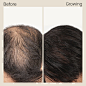 Hair Growth Serum - Google 搜尋