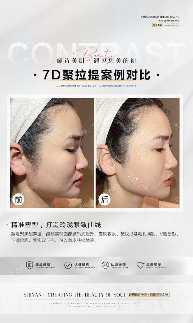 医美整形案例前后对比海报模板