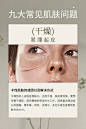 牛油果绿｜九大常见肌肤问题科普小知识 - 小红书