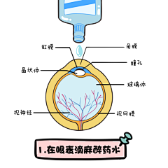 逃太郎采集到眼科