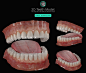 Free 3D Teeth Model, Ben | 3D Gladiator : Don’t waste your precious time creating teeth! Download and use the 3D Gladiator Teeth Set instead. The package contains the original ZBrush file and the Marmoset Toolbag scene. The model can be found here:<br/