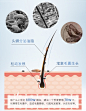 舒霖除螨洗发水去屑控油净痘去螨虫止痒洗头膏头皮毛囊发炎专用-tmall.com天猫