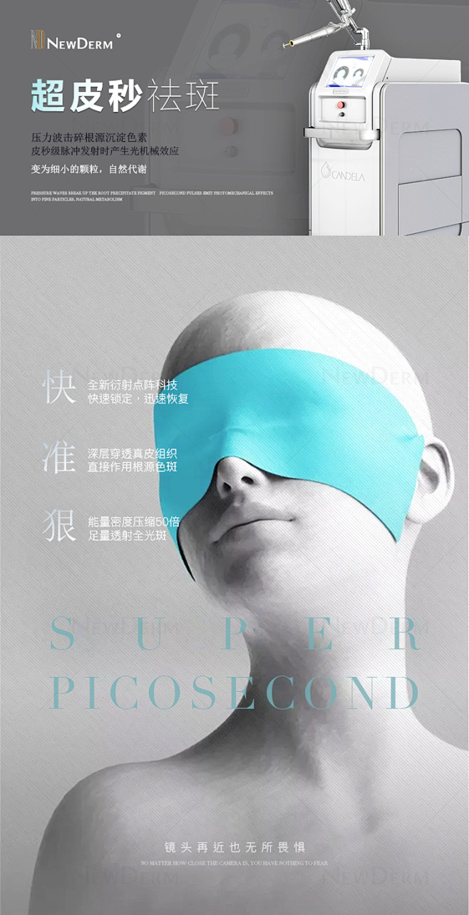 超皮秒祛斑