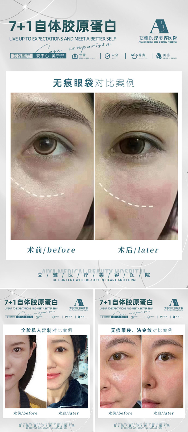 医美面部对比案例设计师医美面部对比案例