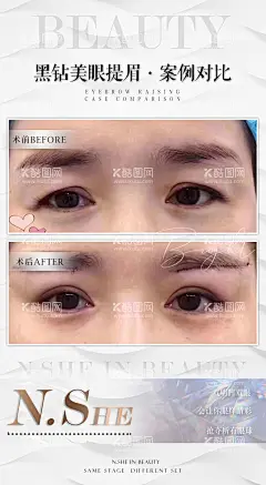 医美案例图  - 源文件下载【酷图网】海报,医美,美容,案例,整形,对比图,