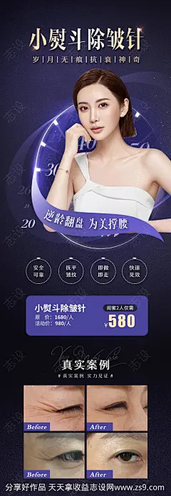 医美整形美容除皱针海报案例对比模特-源文件-志设网-zs9.com