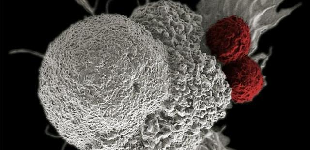 一种全新对付癌细胞的方法明年将进入临床