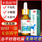 灰指甲专用药脱甲膏软甲抑菌治疗冰醋酸脚趾增厚型去除灰甲净官网-tmall.com天猫