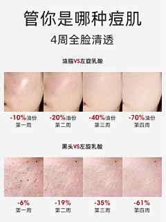 这些年的青春&与爱无关采集到对比