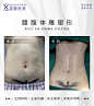 医美效果图对比图前后术后案例效果整形微整医疗美容