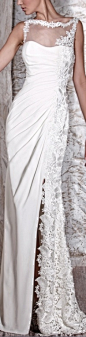 Tony Ward