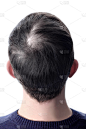 男人的头发用秃头补丁之前使用化妆品粉加厚头发。白色隔离.