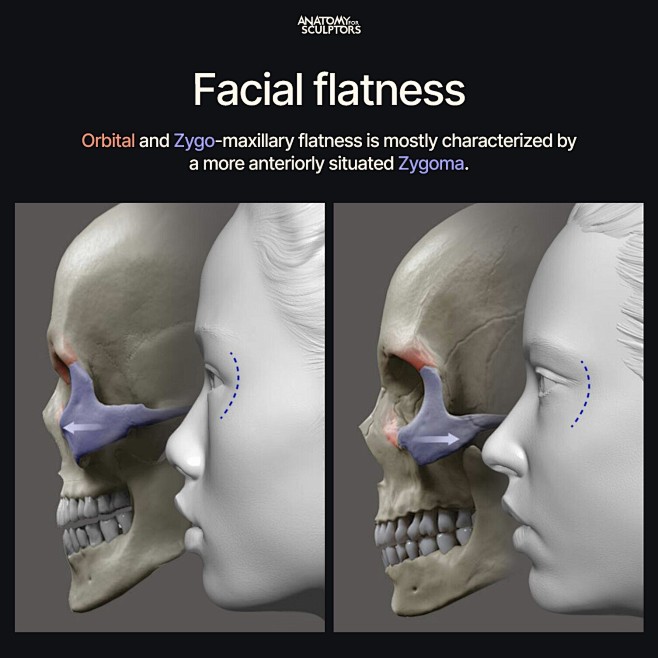 Facial flatness