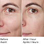 BEFORE AFTER FACE SERUM