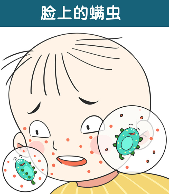 螨虫 螨虫滋生 脸上 冒痘 床铺 可爱 ...