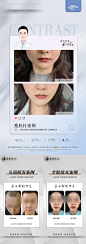 医美简约案例-源文件【享设计】