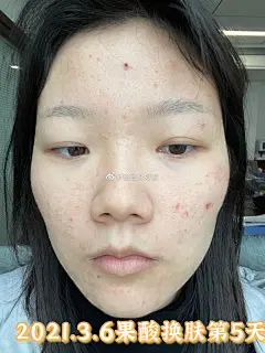 @脸脸变好看 的个人主页 - 微博