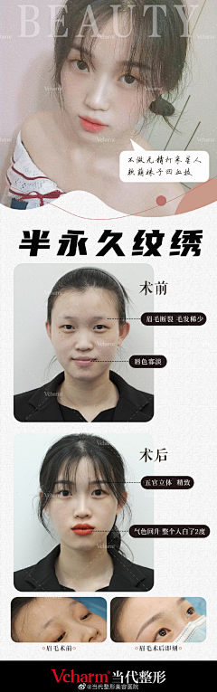 小笨12138采集到案例
