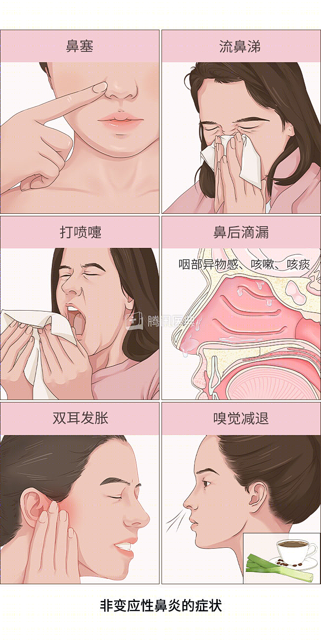鼻炎配图