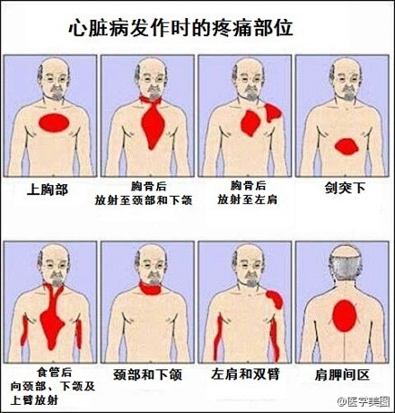 当出现以下部位疼痛时，需警惕心脏病发作