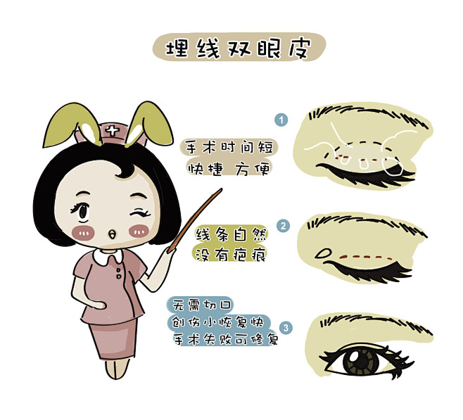 17:02:26埋线双眼皮医美卡通 / 相关素材无聊的星该采集也在以下画板